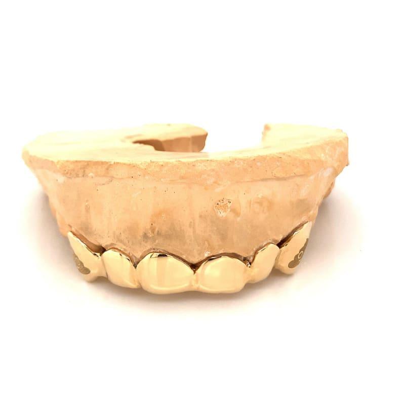6pc Gold Emoji Top Grillz - Seattle Gold Grillz