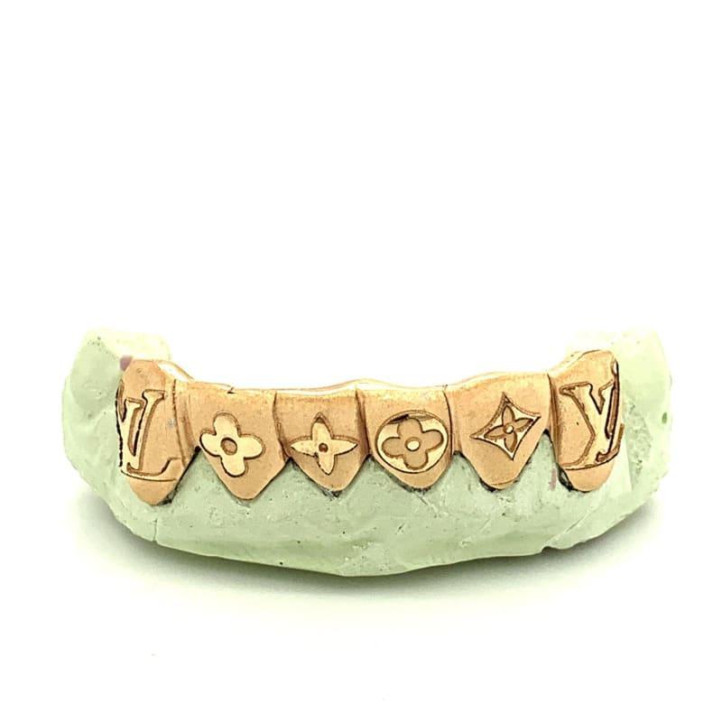 6pc Gold Lasered Bottom Grillz - Seattle Gold Grillz
