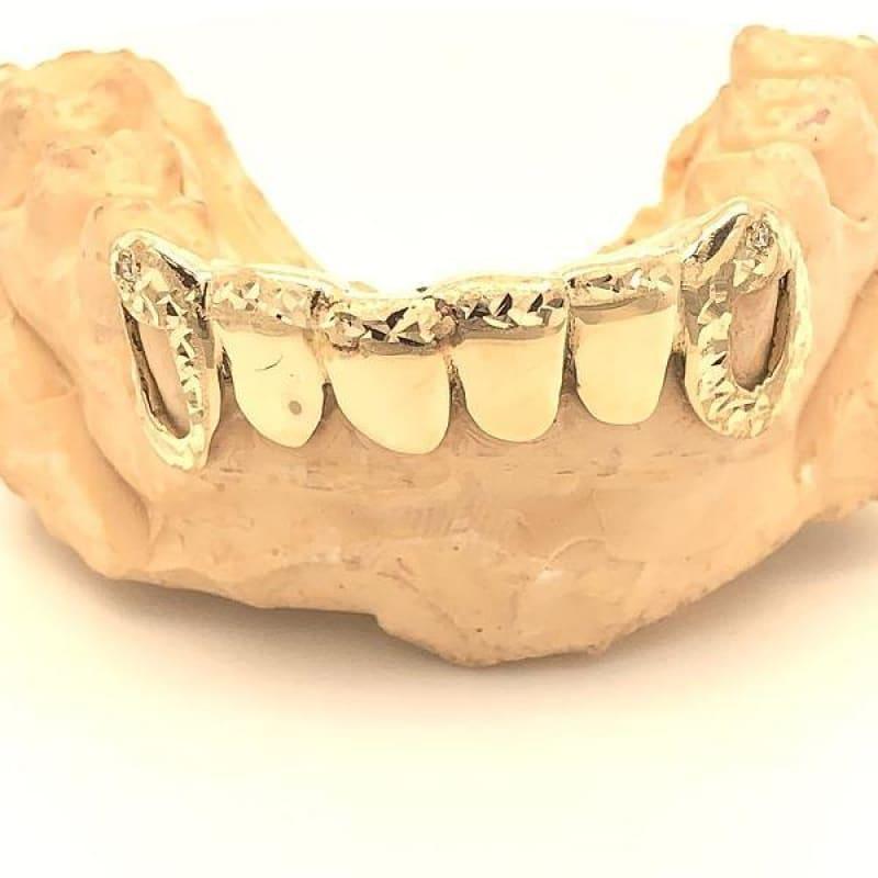 6pc Gold Open Face Grillz - Seattle Gold Grillz