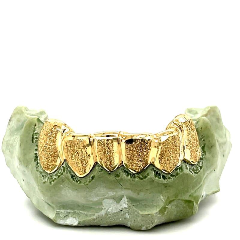6pc Gold Polished Dusted Grillz - Seattle Gold Grillz
