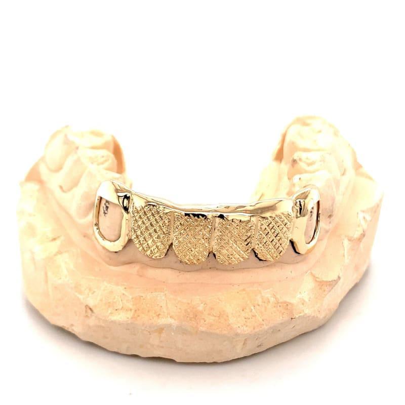 6pc Gold Snowflake Open Face Grillz - Seattle Gold Grillz