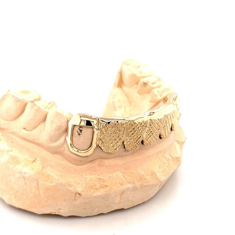 6pc Gold Snowflake Open Face Grillz - Seattle Gold Grillz