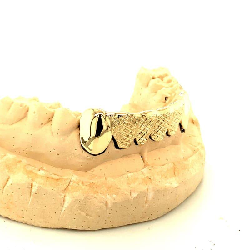 6pc Gold Snowflake Polished Bottom Grillz - Seattle Gold Grillz