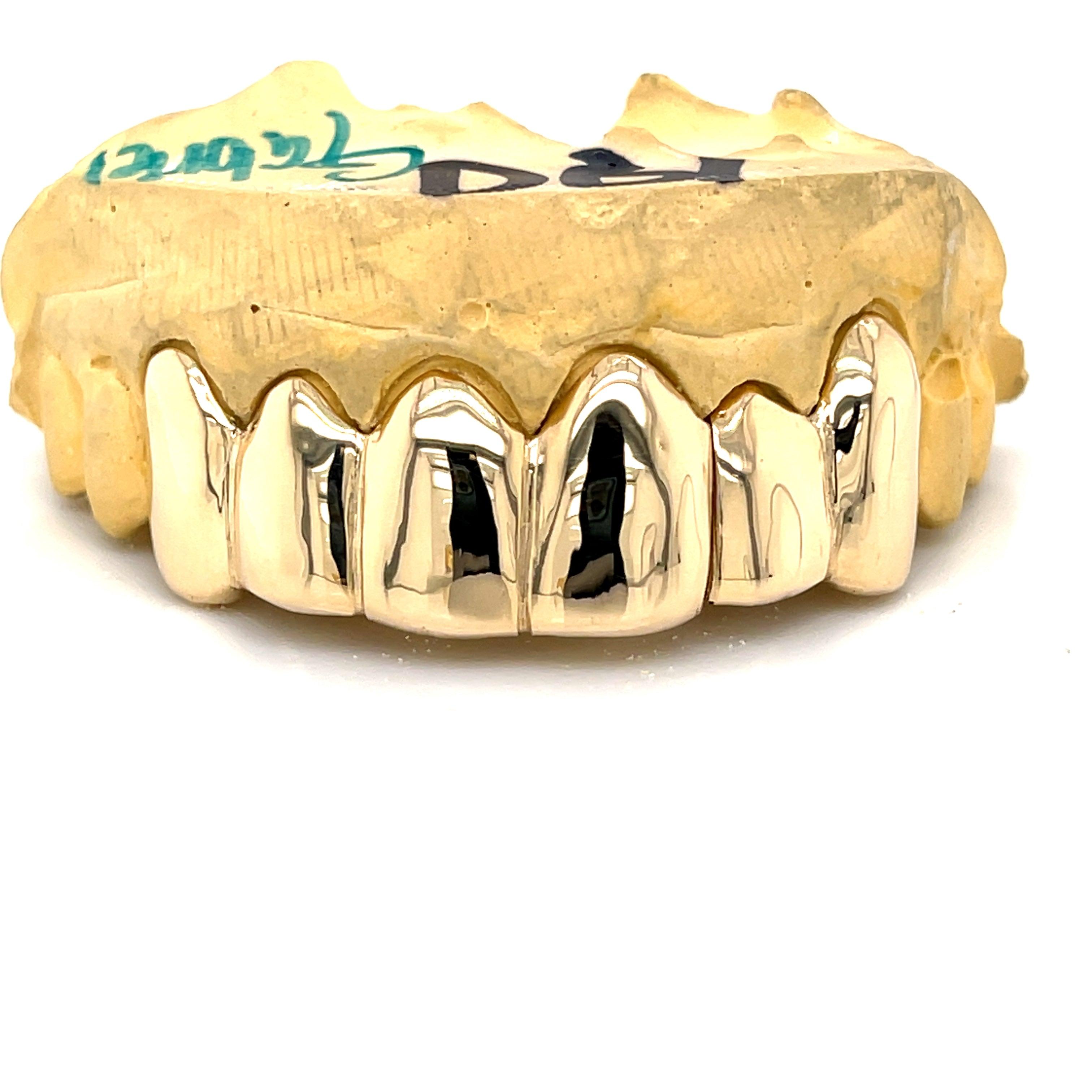 6pc Gold Split Top Grillz - Seattle Gold Grillz