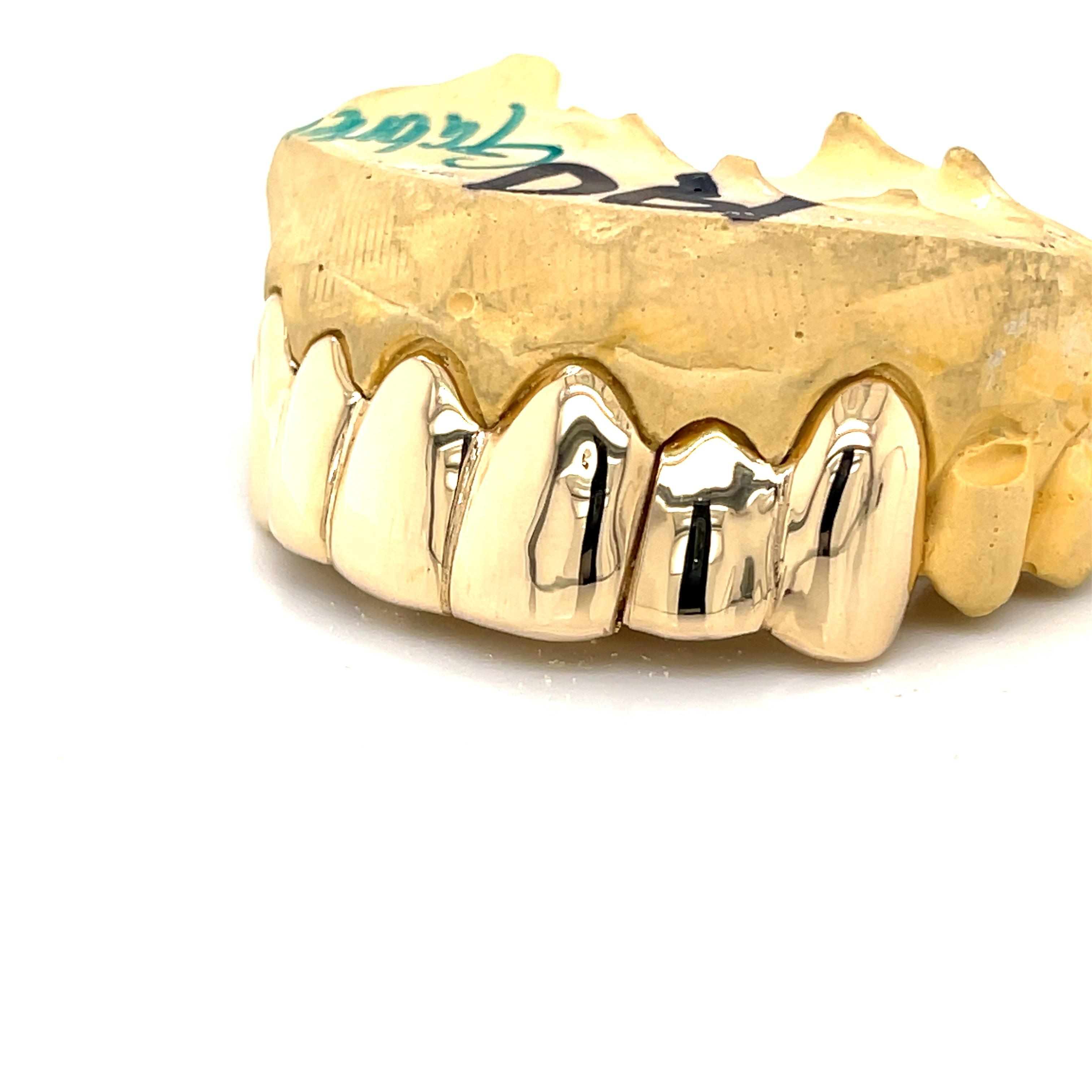 6pc Gold Split Top Grillz - Seattle Gold Grillz