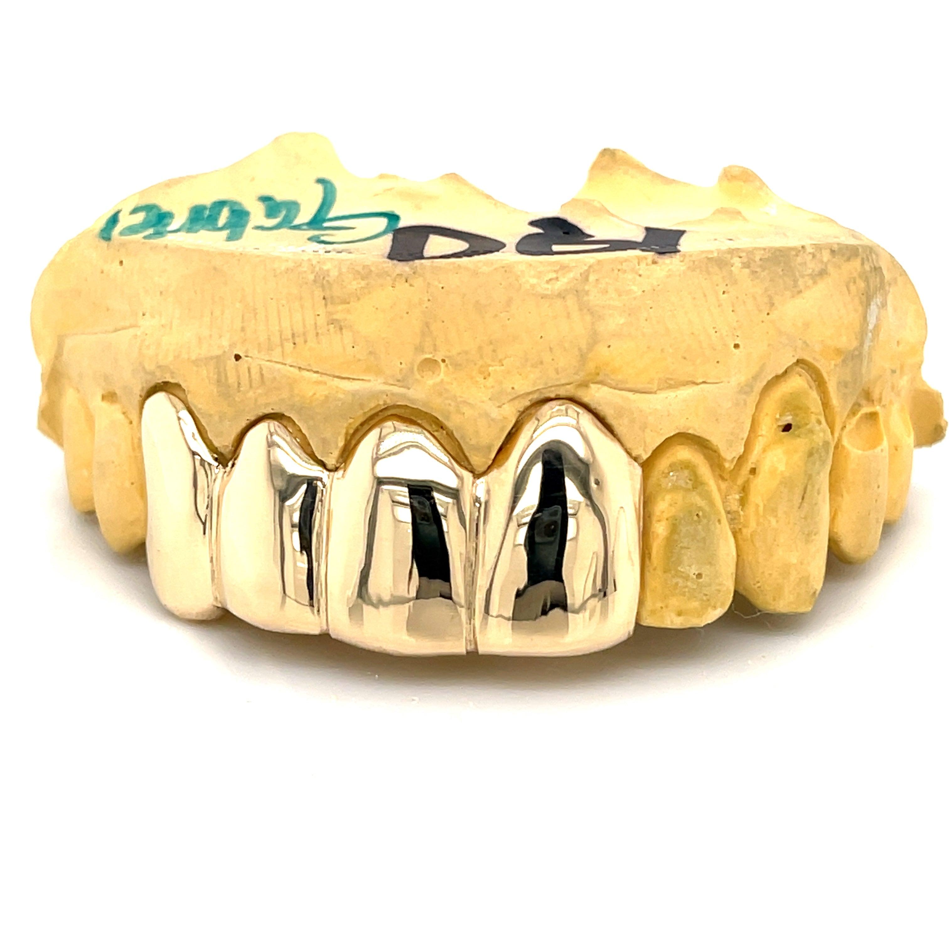 6pc Gold Split Top Grillz - Seattle Gold Grillz