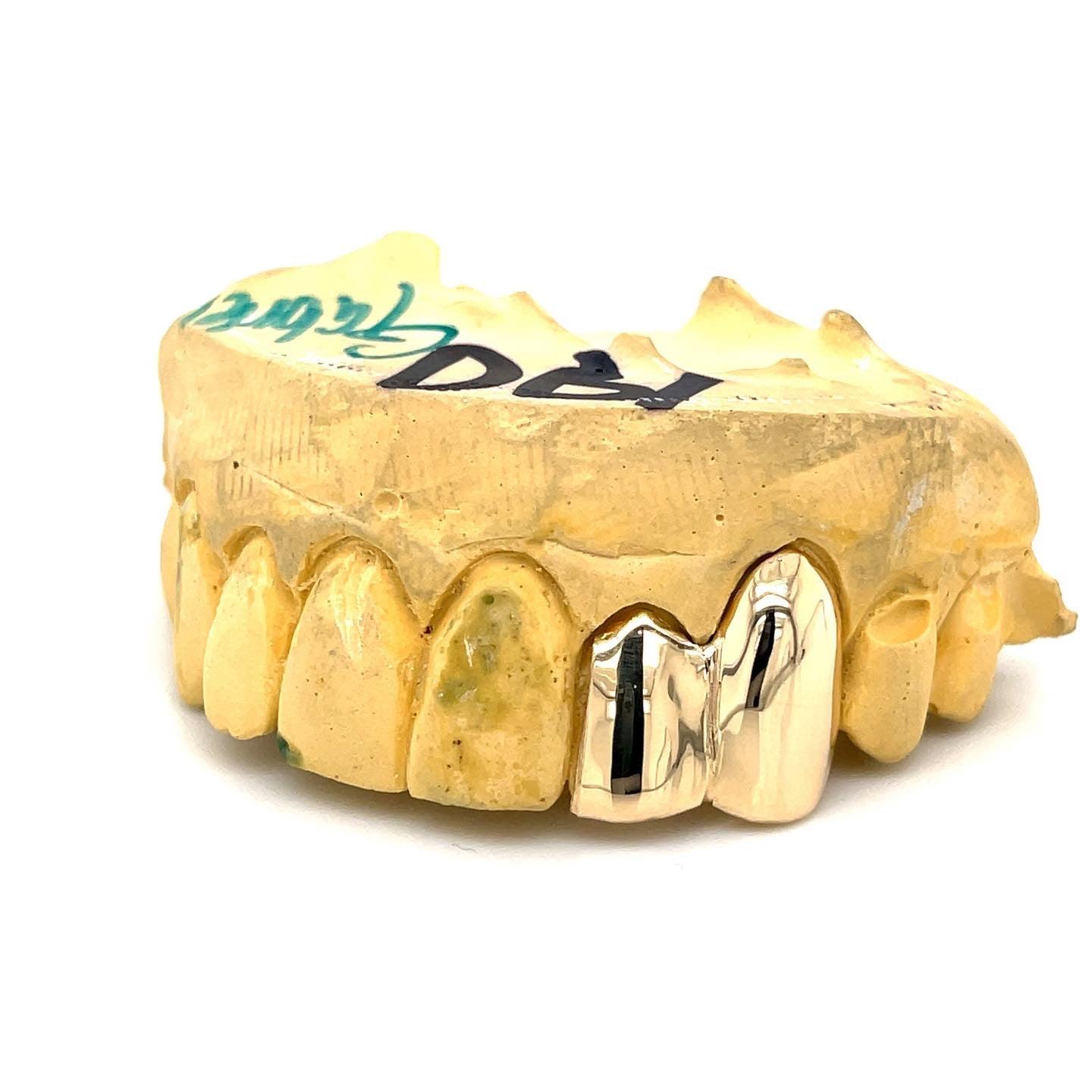 6pc Gold Split Top Grillz - Seattle Gold Grillz