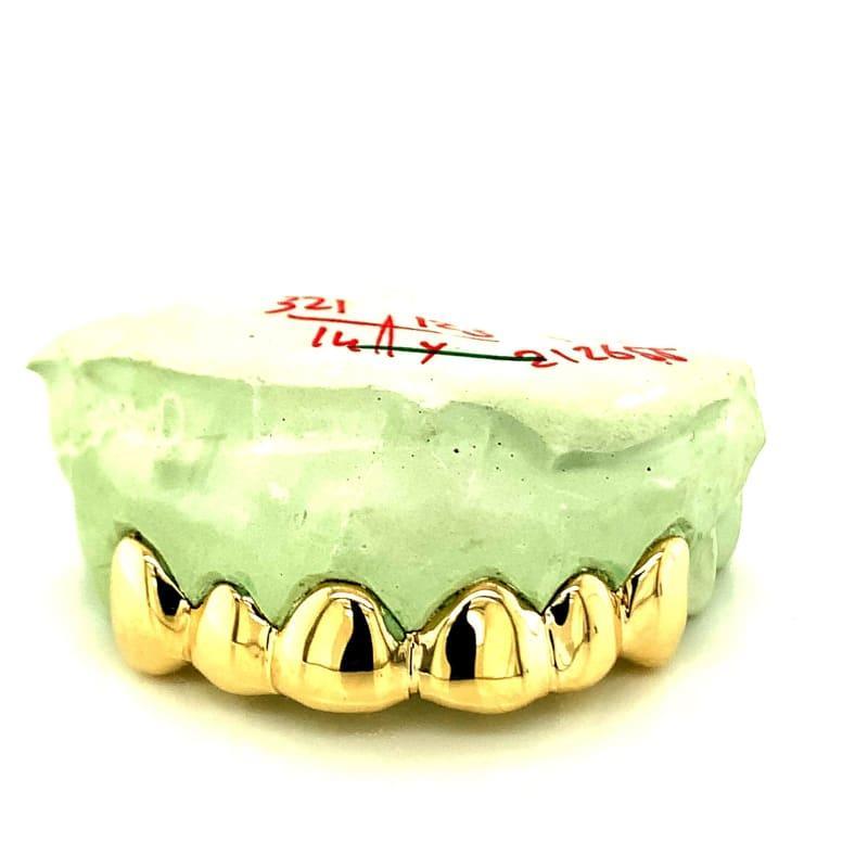 6pc Gold Top Grillz - Seattle Gold Grillz