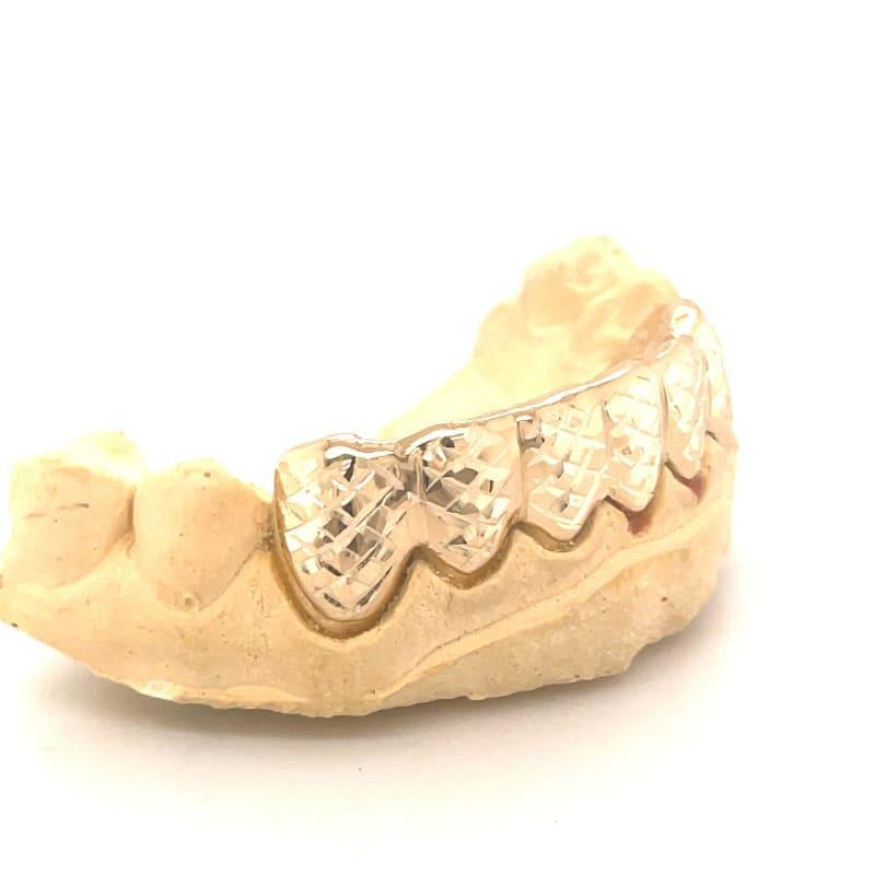 6pc Gold Trillion Cut Grillz - Seattle Gold Grillz