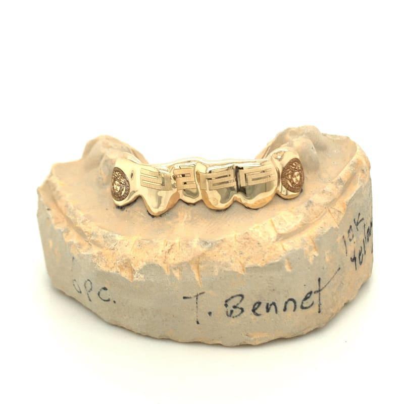 6pc Gold Versace Greek Key Bottom Grillz - Seattle Gold Grillz