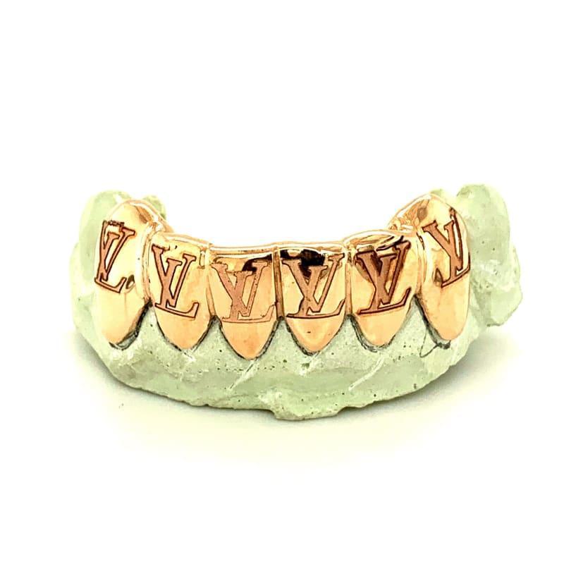 6pc Rose Gold Custom Grillz - Seattle Gold Grillz