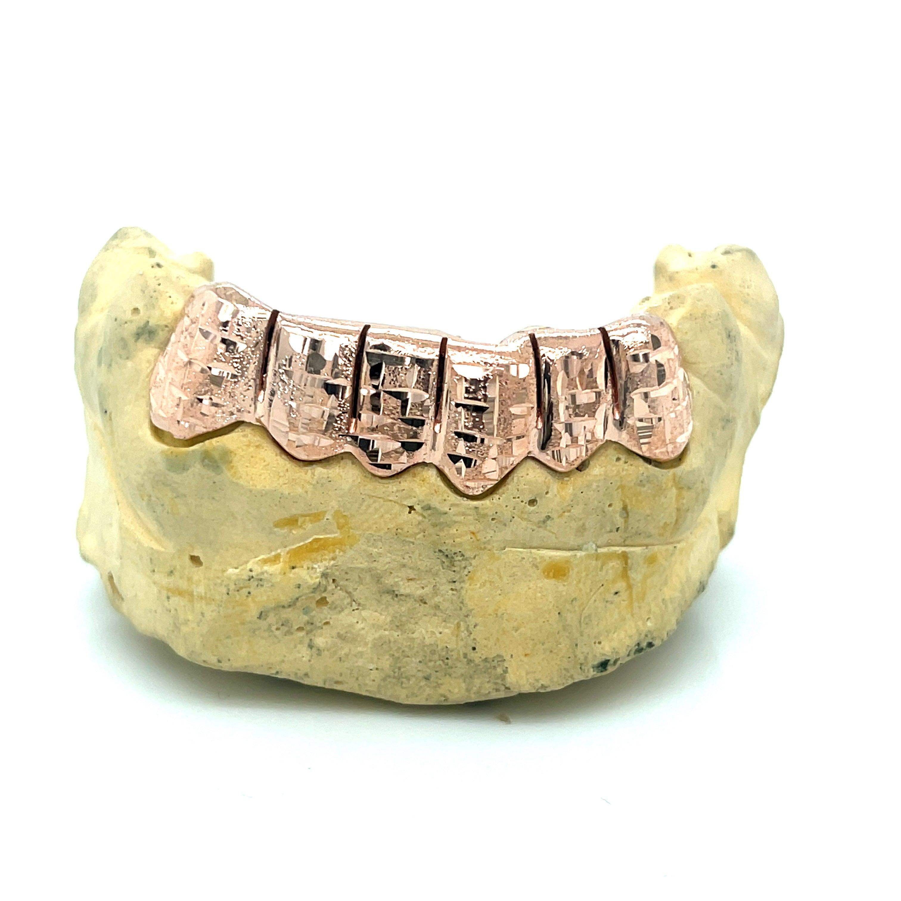6pc Rose Gold Dusted Bricks Bottom Grillz - Seattle Gold Grillz
