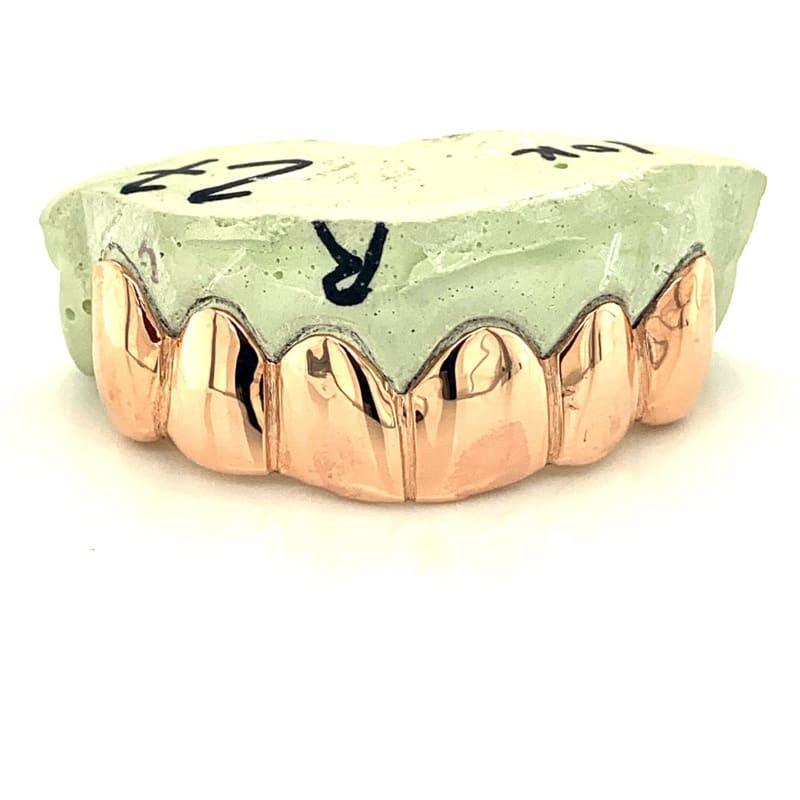 6pc Rose Gold Top Grillz - Seattle Gold Grillz