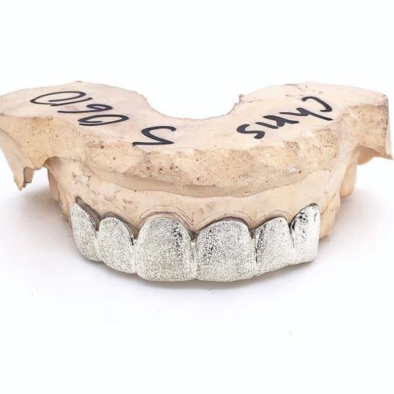 6pc Silver Diamond Dust Grillz - Seattle Gold Grillz