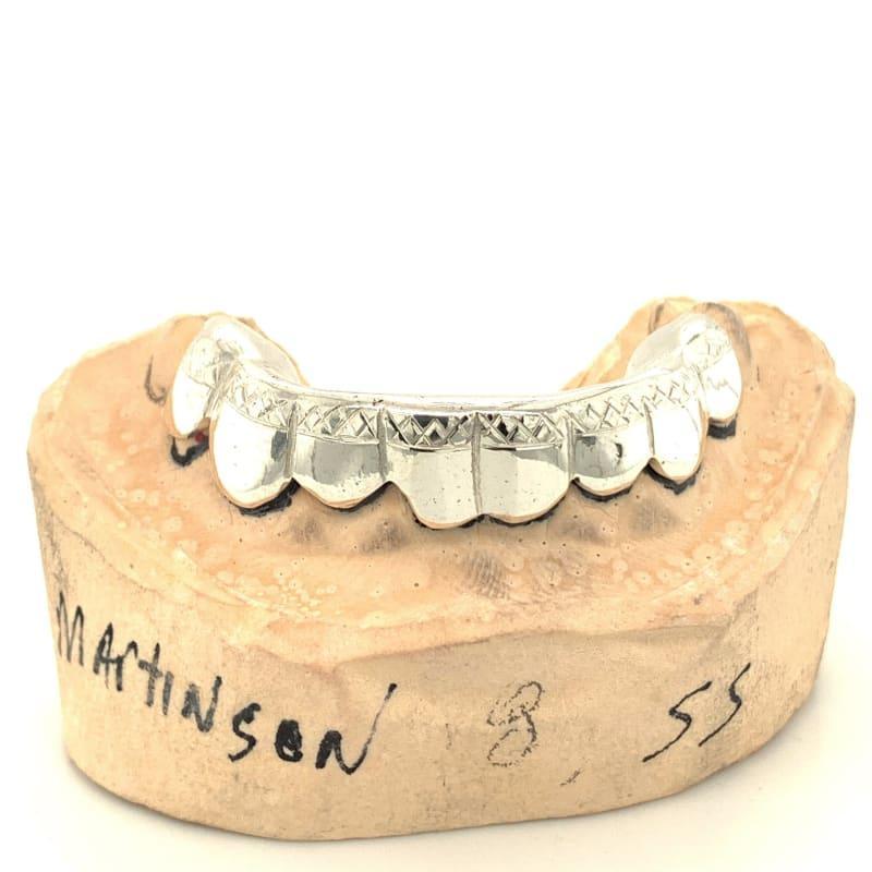 6pc Silver Trillion Tipped Grillz - Seattle Gold Grillz