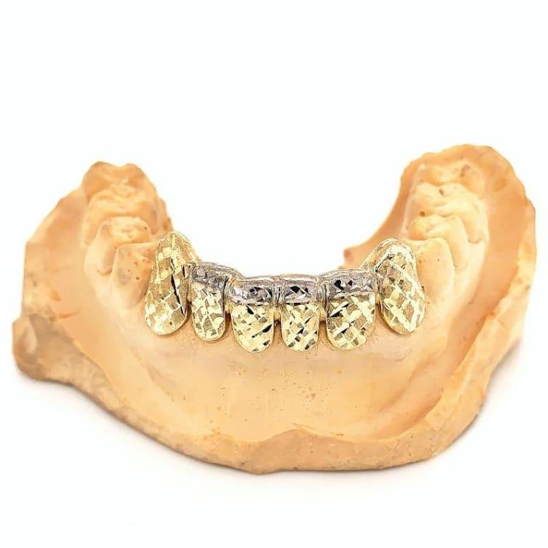 6pc Two Tone Dusted Grillz - Seattle Gold Grillz