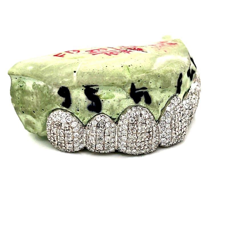 6pc White Gold Chandelier Diamond Grillz - Seattle Gold Grillz