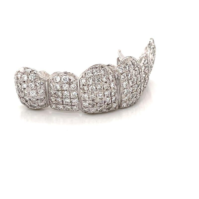 6pc White Gold Diamond Grillz (Box Set) - Seattle Gold Grillz