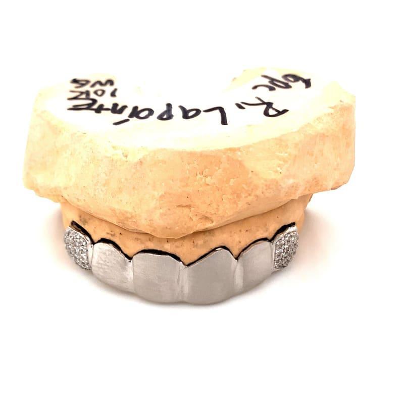 6pc White Gold Satin Grillz - Seattle Gold Grillz