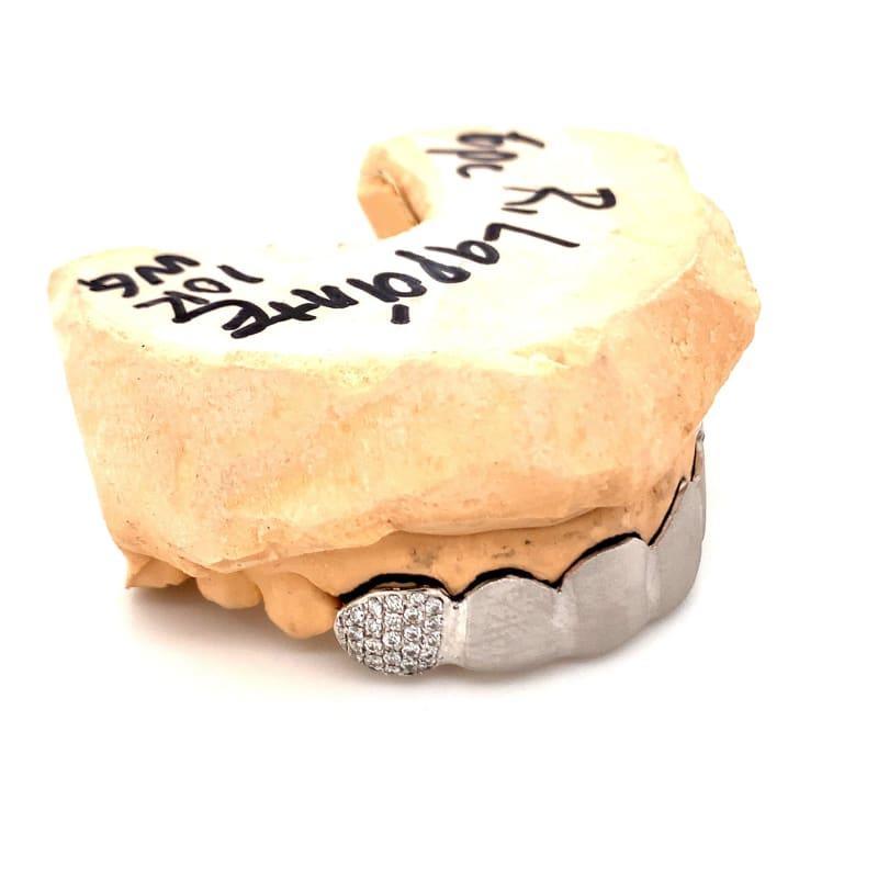 6pc White Gold Satin Grillz - Seattle Gold Grillz