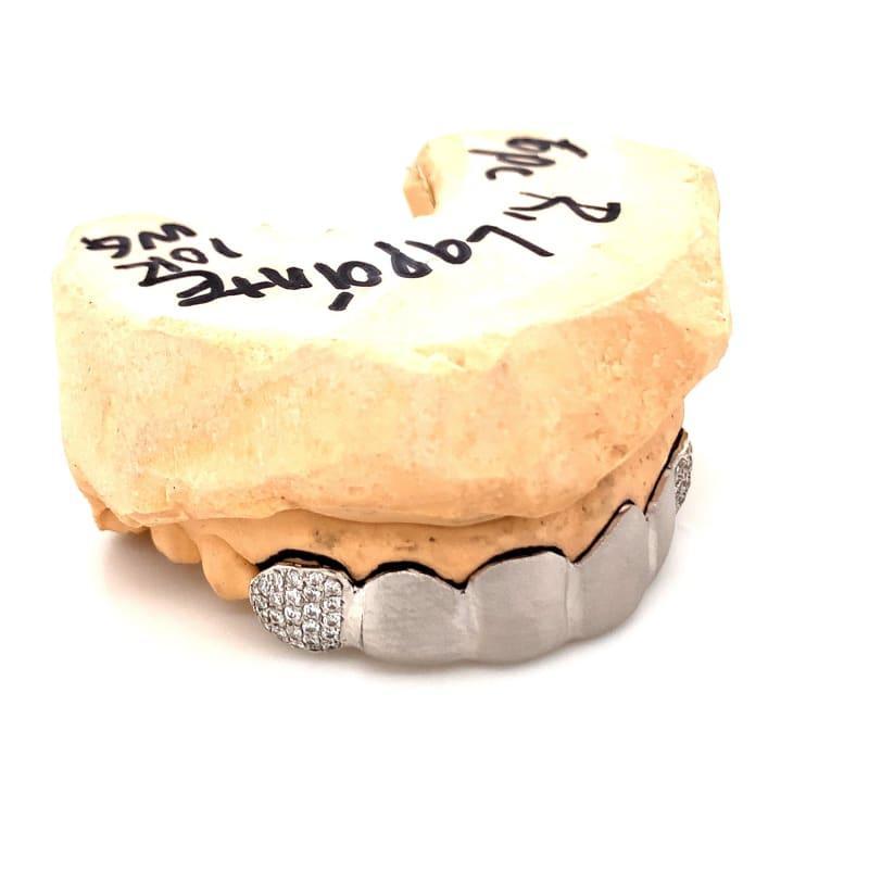 6pc White Gold Satin Grillz - Seattle Gold Grillz