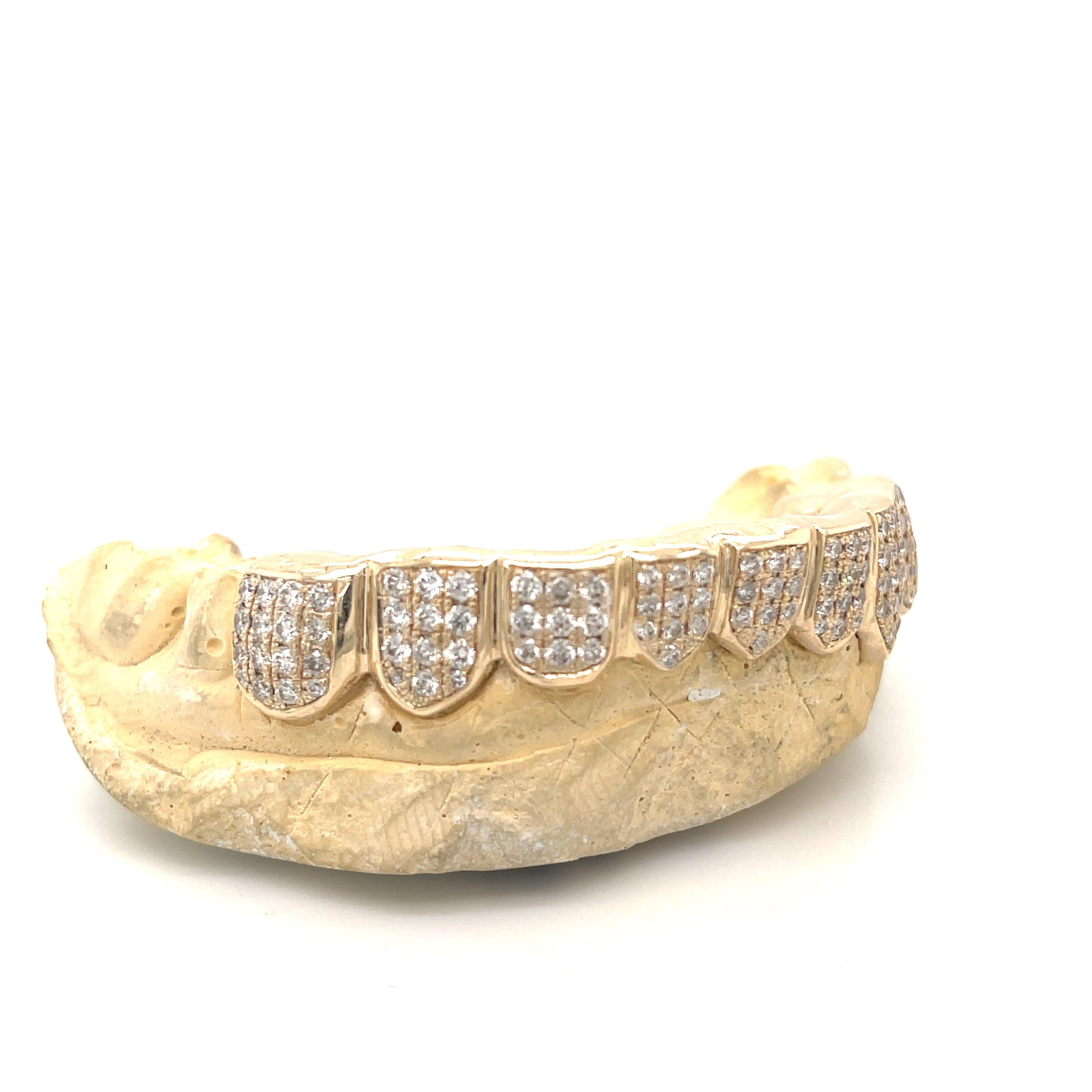 8pc Gold Box Set Bottom Grillz - Seattle Gold Grillz