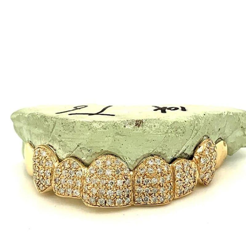 8pc Gold Box Set Diamond Top Grillz - Seattle Gold Grillz