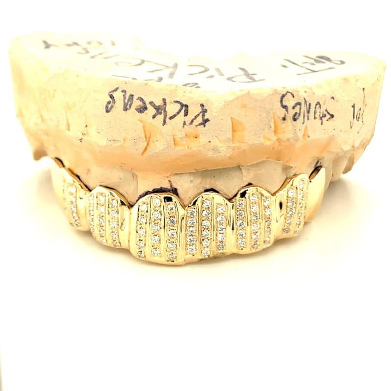8pc Gold Channel Set Diamond Top Grillz - Seattle Gold Grillz