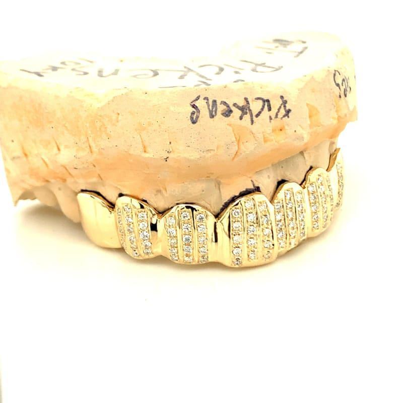 8pc Gold Channel Set Diamond Top Grillz - Seattle Gold Grillz