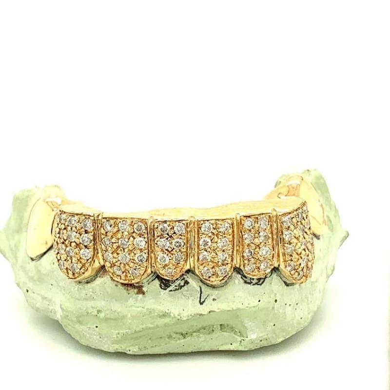 8pc Gold Diamond Bottom Grillz - Seattle Gold Grillz