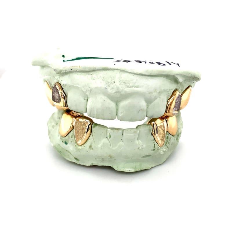 8pc Gold Diamond Dust Grillz - Seattle Gold Grillz