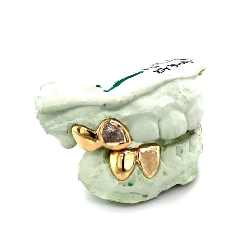 8pc Gold Diamond Dust Grillz - Seattle Gold Grillz