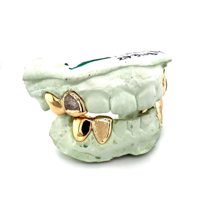 8pc Gold Diamond Dust Grillz - Seattle Gold Grillz