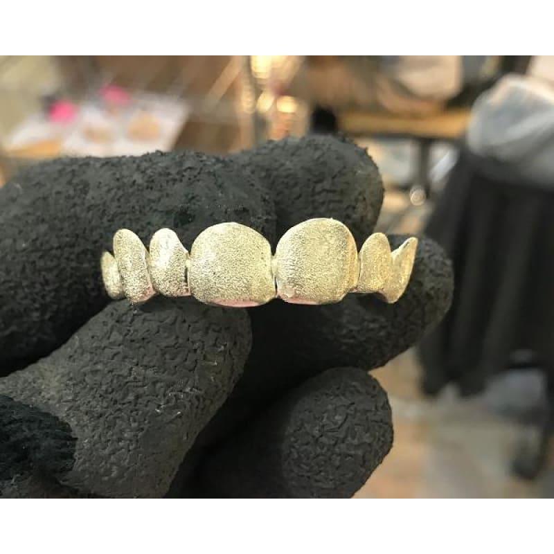 8pc Gold Diamond Dust Top Grillz - Seattle Gold Grillz