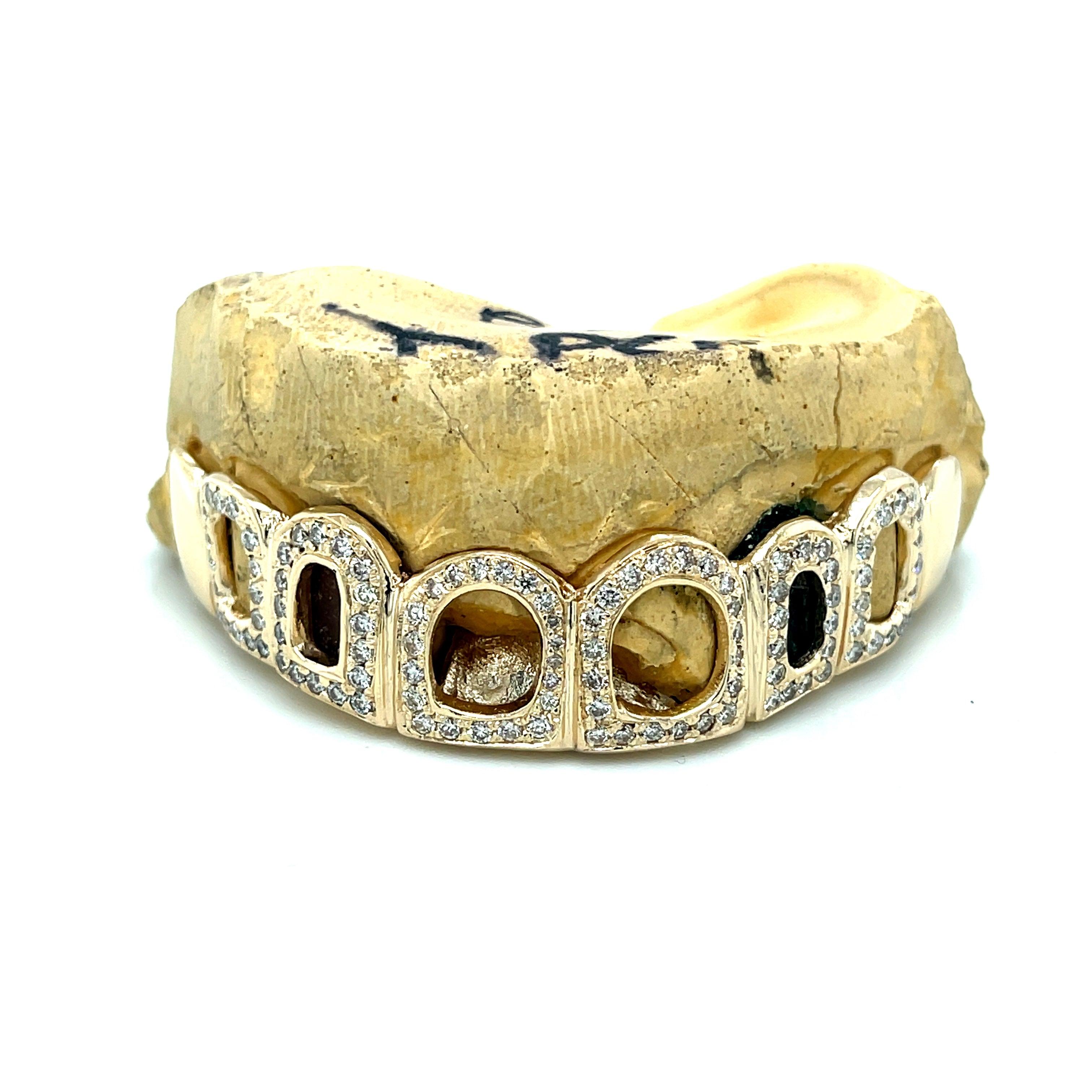 8pc Gold Diamond Open Face Grillz - Seattle Gold Grillz