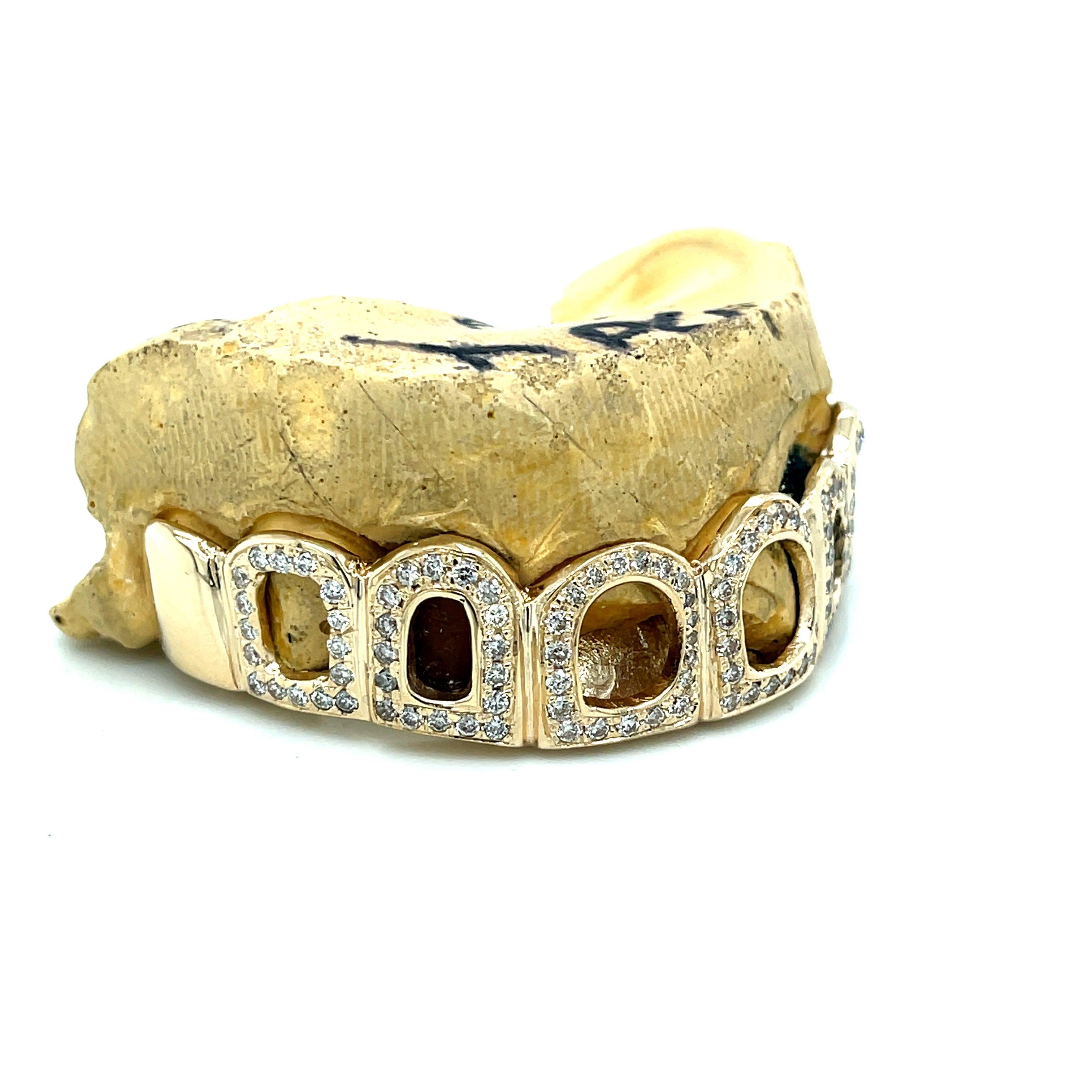 8pc Gold Diamond Open Face Grillz - Seattle Gold Grillz