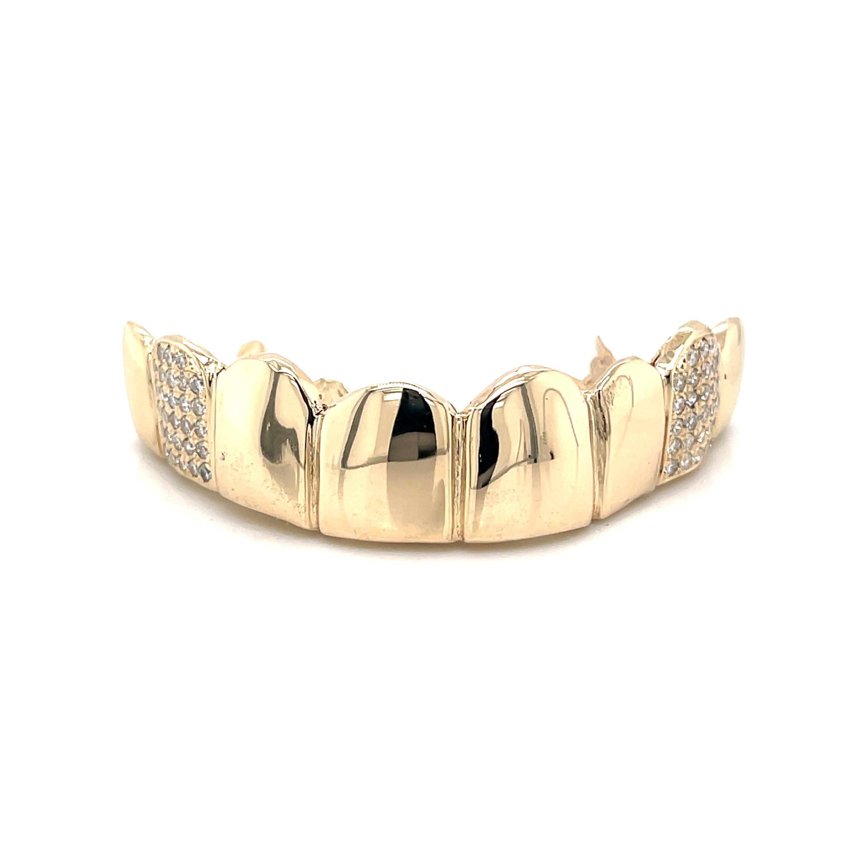 8pc Gold Diamond Top Grillz - Seattle Gold Grillz