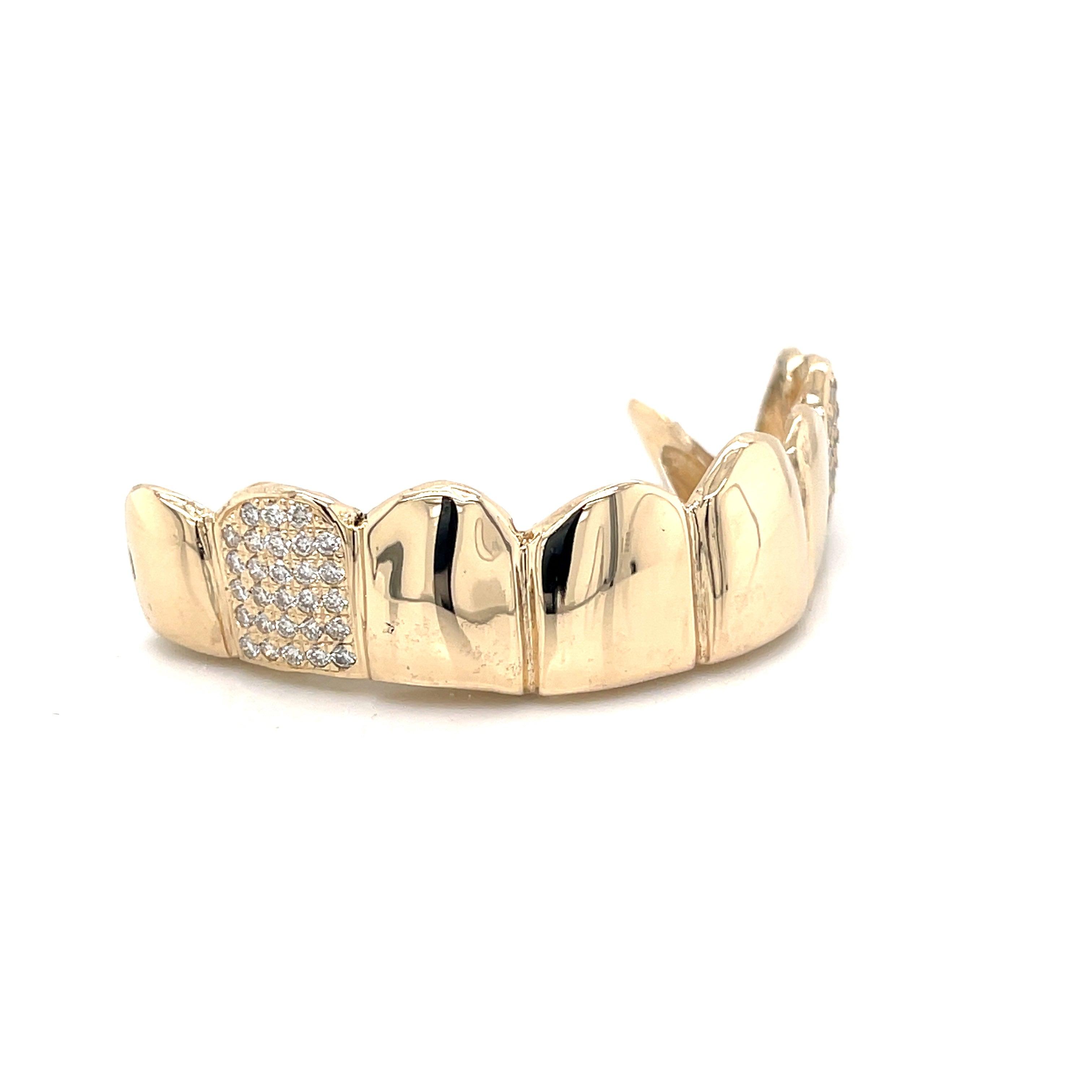 8pc Gold Diamond Top Grillz - Seattle Gold Grillz