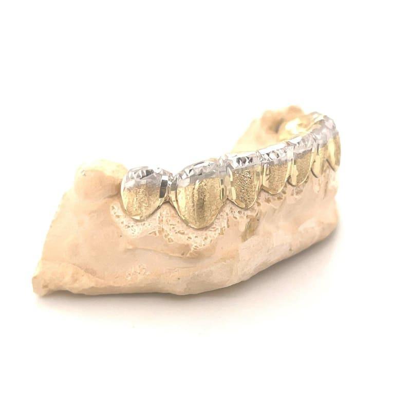 8pc Gold Dusted French Tip Grillz - Seattle Gold Grillz