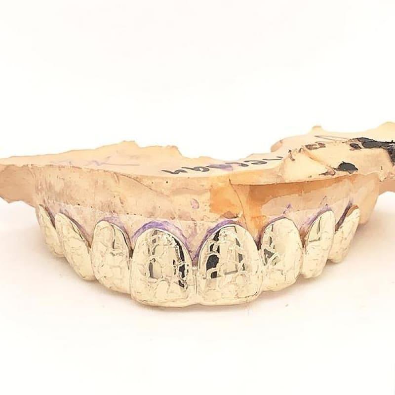 8pc Gold Gator Cut Top Grillz - Seattle Gold Grillz