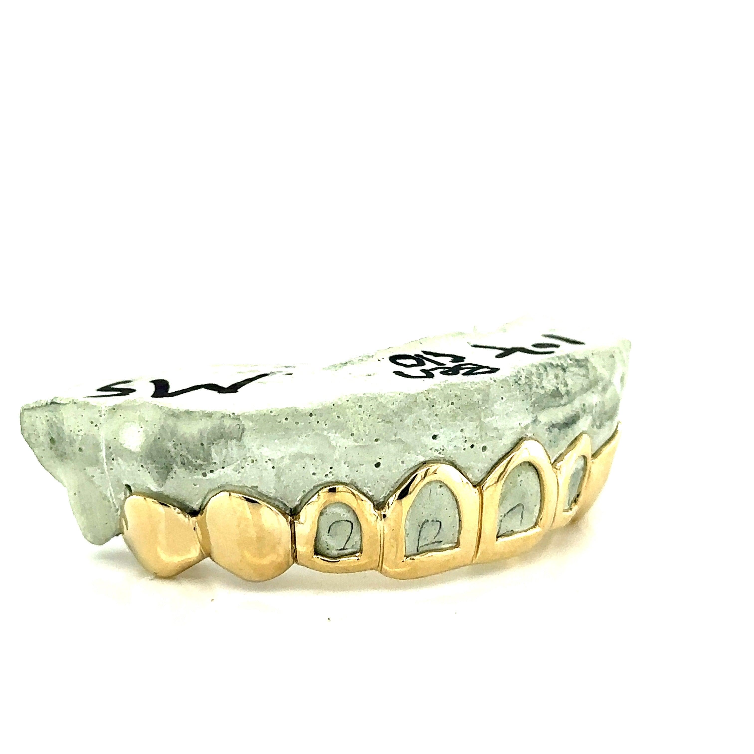 8pc Gold Open Face Top Grillz - Seattle Gold Grillz