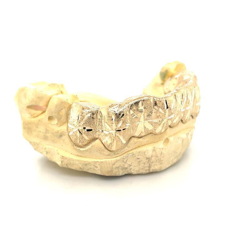 8pc Gold Snowfall Bottom Grillz - Seattle Gold Grillz