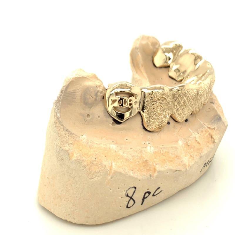 8pc Gold Snowflake Open Face State Grillz - Seattle Gold Grillz