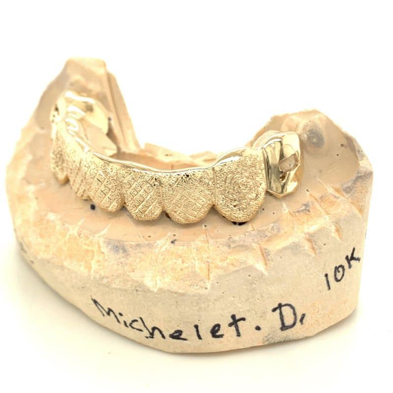 8pc Gold Snowflake Open Face State Grillz - Seattle Gold Grillz