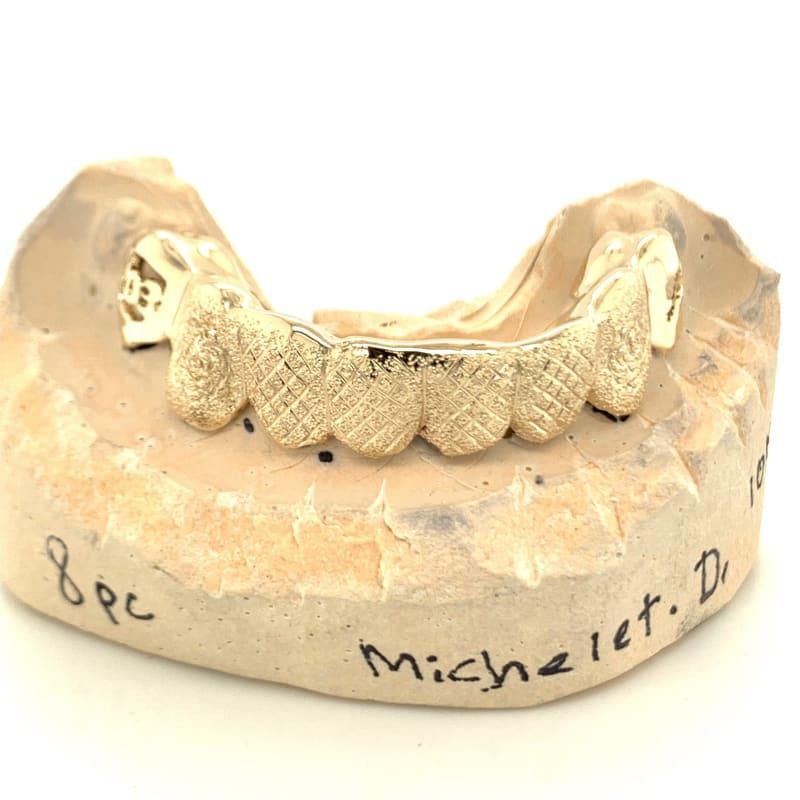 8pc Gold Snowflake Open Face State Grillz - Seattle Gold Grillz