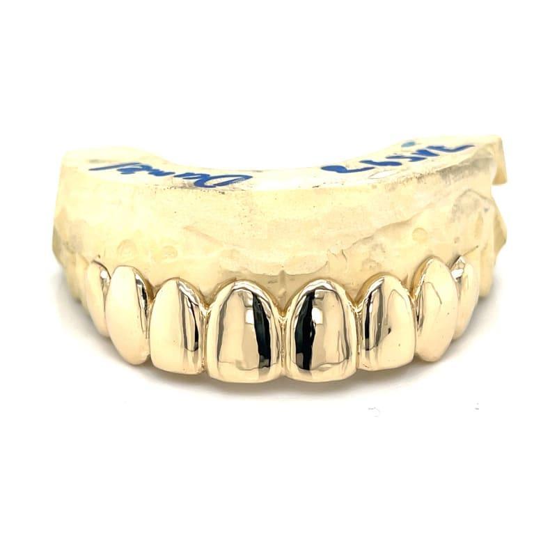 8pc Gold Top Grillz - Seattle Gold Grillz