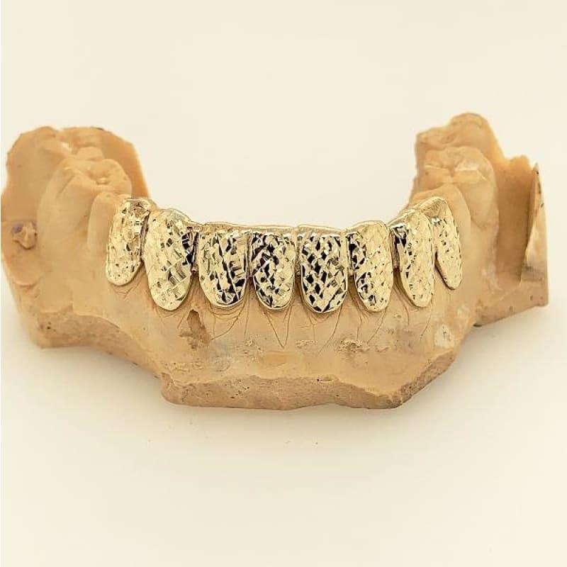 8pc Gold Trillion Cut Bottom Grillz - Seattle Gold Grillz