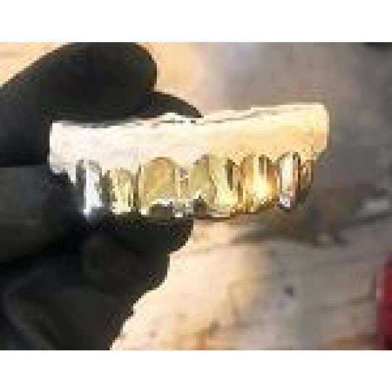 8pc Gold White Gold Fang Top Grillz - Seattle Gold Grillz