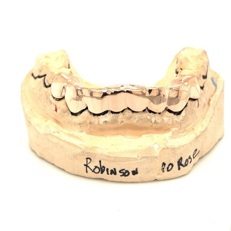 8pc Rose Gold Bottom Grillz - Seattle Gold Grillz