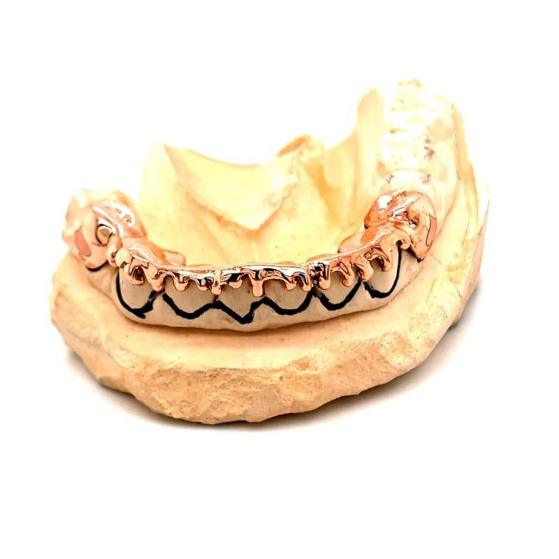 8pc Rose Gold Drip Grillz - Seattle Gold Grillz